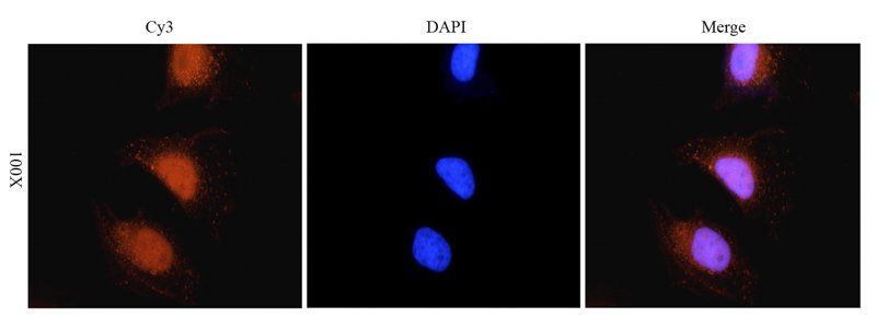 RANTES antibody