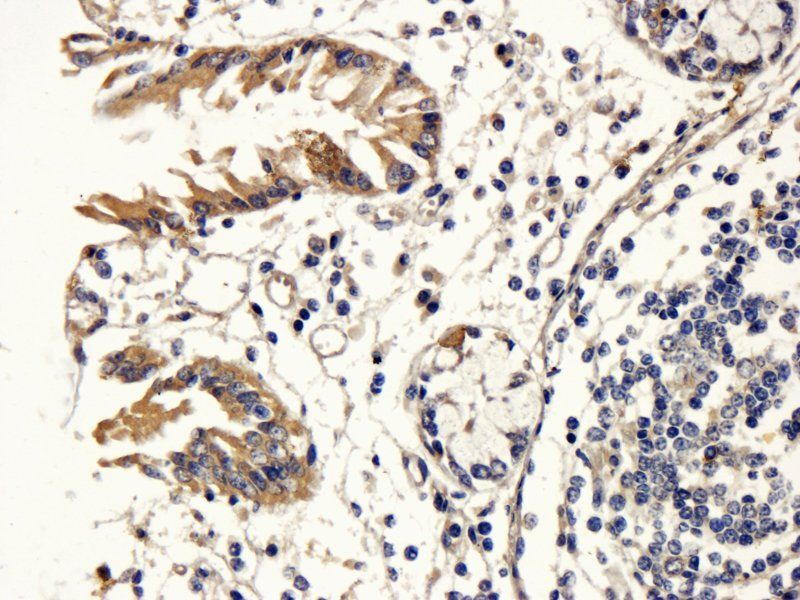 RANTES antibody