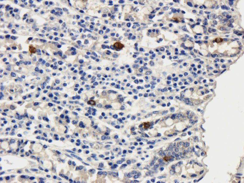 RANTES antibody