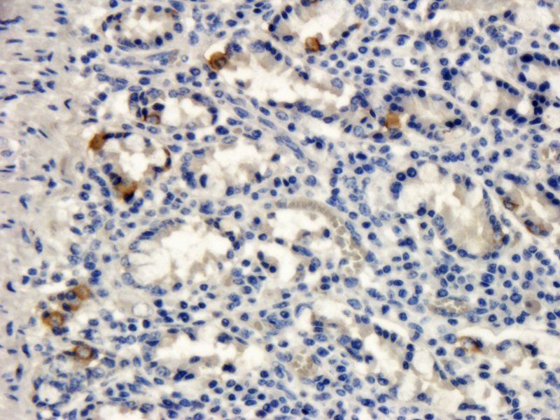 RANTES antibody