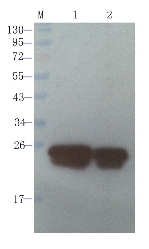 RANTES antibody