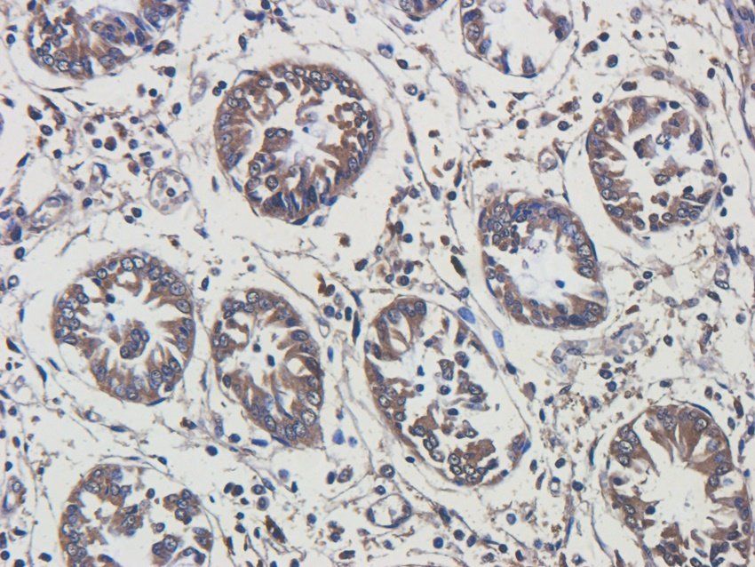 RANTES antibody