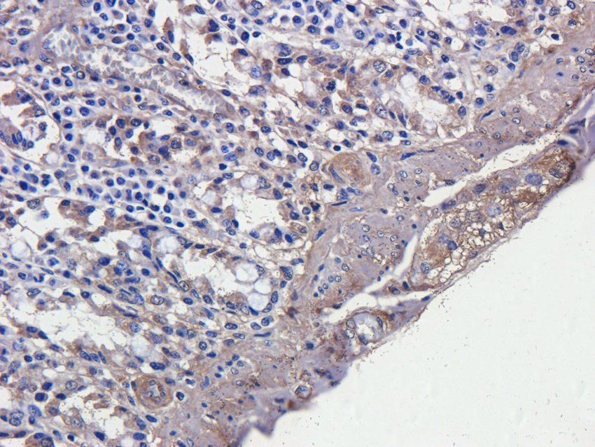 RANTES antibody