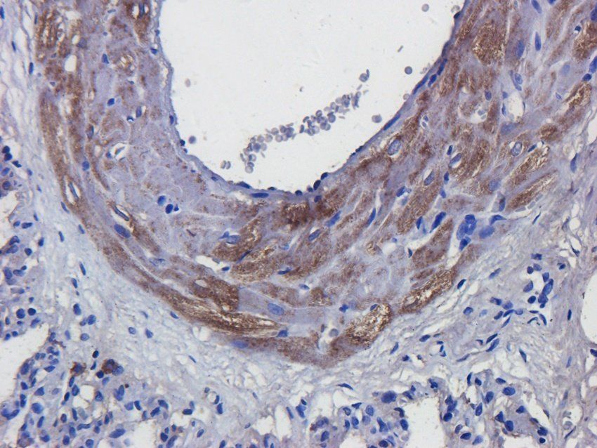 RANTES antibody