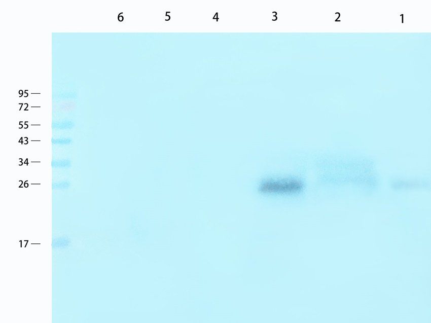 RANTES antibody