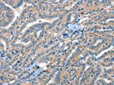 RAP1A Antibody