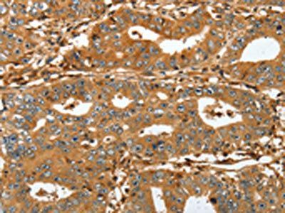 RAP1A Antibody