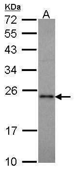 Cytokeratin 2 antibody