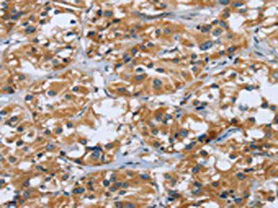 RAP1B Antibody