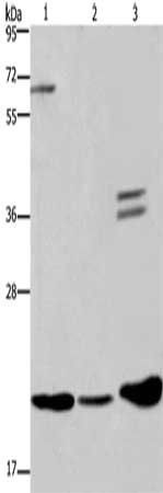 RAP1B Antibody