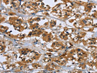 RAP1B Antibody