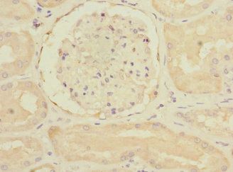RAP2B Antibody