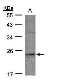 RAP2C, member of RAS oncogene family Antibody