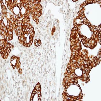 RAP2C, member of RAS oncogene family precursor antibody