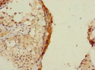 RAPGEF4 Antibody
