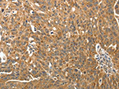 RARA Antibody