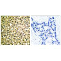 RARB Antibody