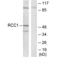 RARB antibody