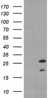 RARRES1 Antibody