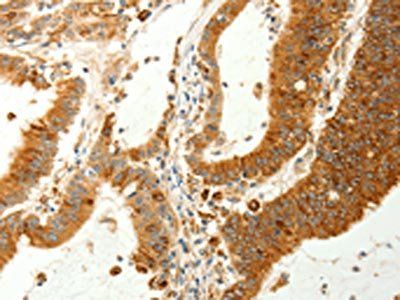 RARRES1 antibody