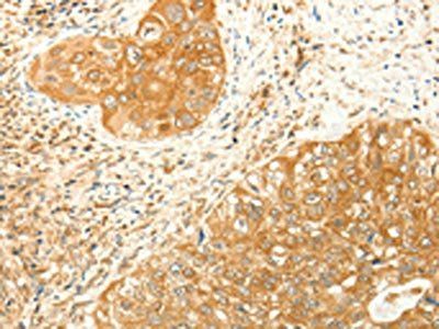 RARRES1 Antibody