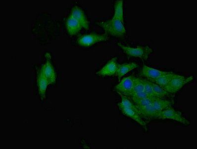 RARRES2 Antibody