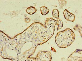 RARRES2 Antibody