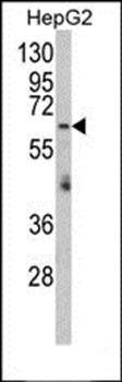 RARS2 antibody