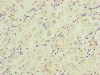 RARS2 Antibody