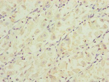 RARS2 antibody