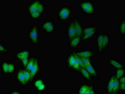 Ras-related protein Rab-10 antibody