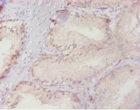 Ras-related protein Rab-10 antibody