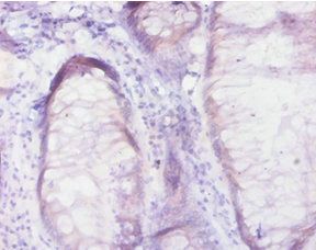 RAB10 Antibody