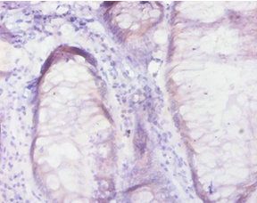 Ras-related protein Rab-10 antibody