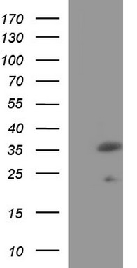 RASA1 Antibody
