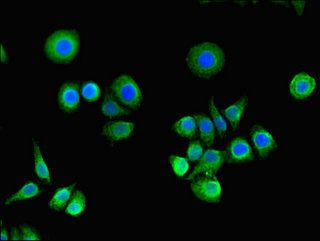 RASA1 Antibody
