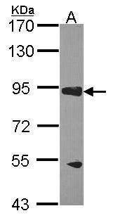 AKAP10 antibody [C3], C-term