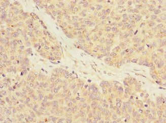 RASA4 Antibody