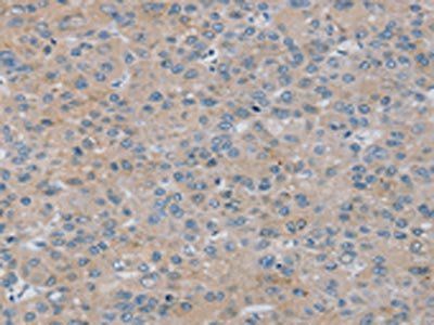 RASA4 Antibody