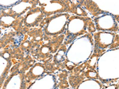 RASAL1 Antibody