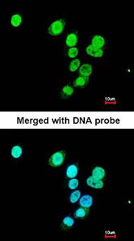 RASAL1 antibody
