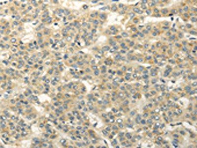 RASD2 Antibody
