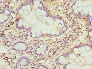 RASGRF1 Antibody