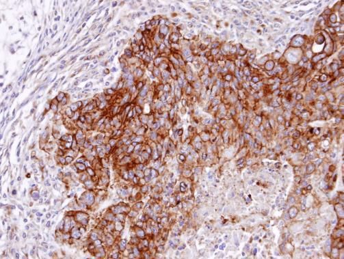 RASGRP4 antibody [N1N2], N-term