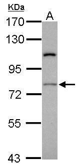 RASGRP4 antibody