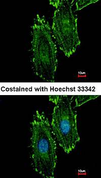 RASGRP4 antibody