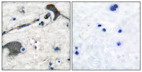 RASH antibody