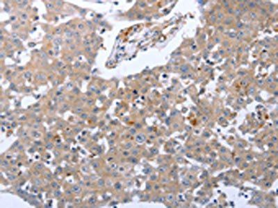 RASSF1 Antibody