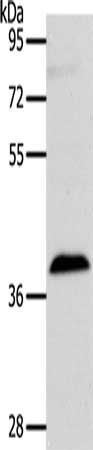 RASSF1 antibody