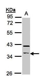 RASSF2 antibody